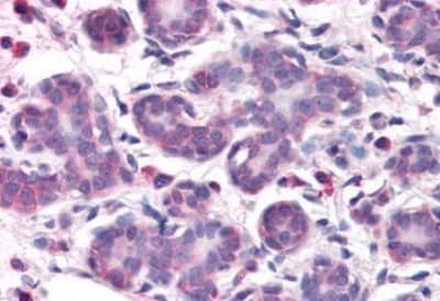 Immunohistochemistry-Paraffin: DC2 Antibody [NBP3-14296]